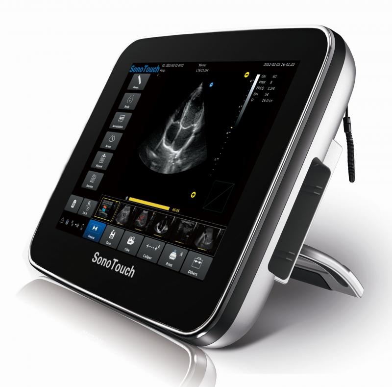 Buy Chison SonoTouch 20 Portable Ultrasound System online