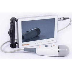 Caresono HD3 Bladder Scanner