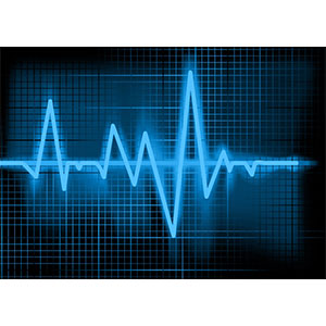 QRS Holter LX Analysis Software