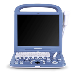 SonoScape S2 Portable Color Doppler Ultrasound System