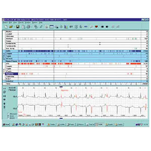 Schiller Holter Software Only