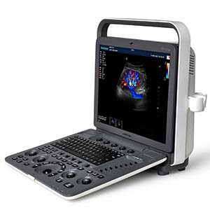 SonoScape S8 Exp Ultrasound System (Demo)