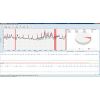 GE Healthcare CardioDay v2.5 Holter Analysis System