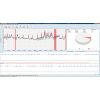 GE Healthcare CardioDay v2.5 Holter Analysis System