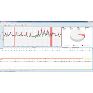 GE Healthcare CardioDay v2.5 Holter Analysis System