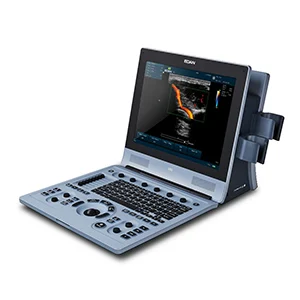 Edan U60 Diagnostic Ultrasound Machine