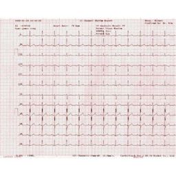 Bionet ECG Paper for Cardiocare 2000, 3000
