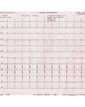 Bionet ECG Paper for Cardiocare 2000, 3000