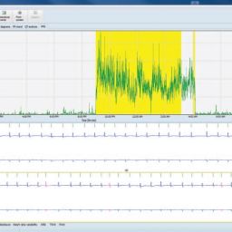 GE Healthcare CardioDay Holter ECG System (Demo)