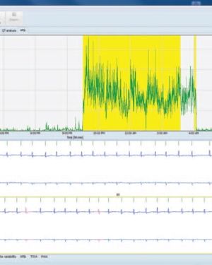 GE Healthcare CardioDay Holter ECG System (Demo)