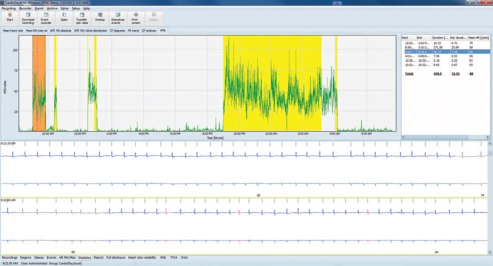 GE Healthcare CardioDay Holter ECG System (Demo)