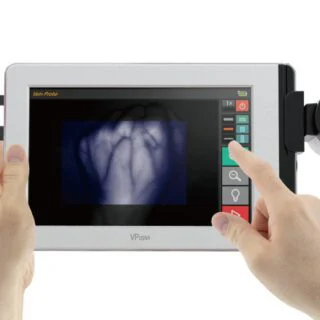 CardioTech Hand Held Vein Probe