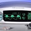 BCI Capnocheck Sleep Capnograph