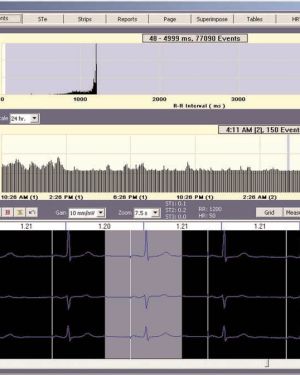 Rozinn Holter Pacemaker Analysis