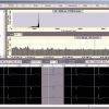 Rozinn Holter 7 Day Analysis