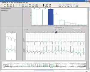 Burdick Vision Holter Analysis System