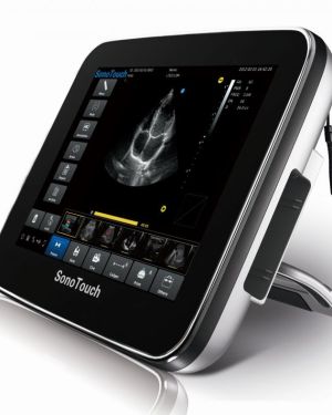 Chison SonoTouch 10 Portable Ultrasound System