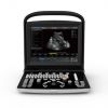 Chison ECO 3 Portable Ultrasound System