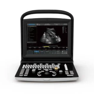 Chison ECO 3 Portable Ultrasound Machine
