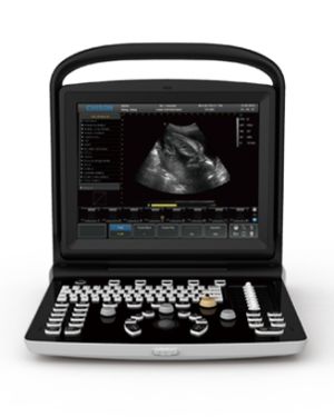 Chison ECO 3 Portable Ultrasound System