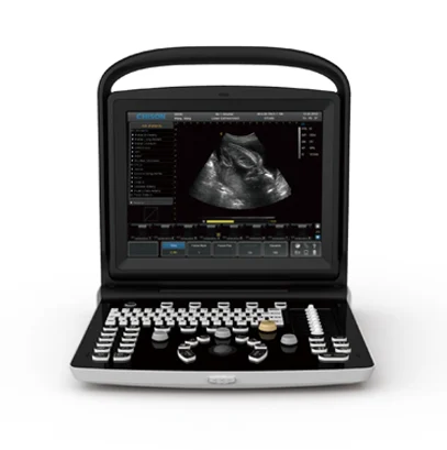 Chison ECO 3 Portable Ultrasound Machine