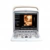 Chison Q5 Portable Ultrasound System