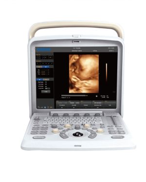 Chison Q5 Portable Ultrasound System