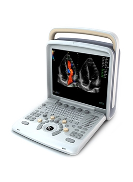 Chison Q6 Portable Ultrasound System