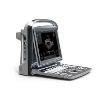 Chison ECO 1 Portable Ultrasound System
