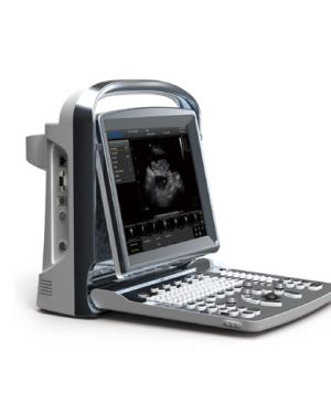 Chison ECO 1 Portable Ultrasound System
