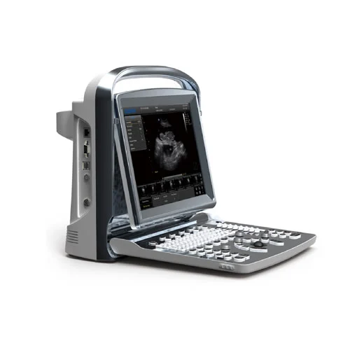 Chison ECO 1 Portable Ultrasound System