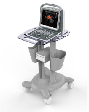 Chison ECO 5 Portable Ultrasound System