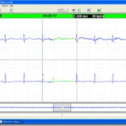 Forest Medical Trillium Silver Holter Analysis Software