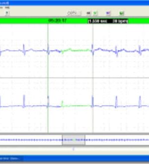 Forest Medical Trillium Silver Holter Analysis Software