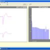 Forest Medical Trillium Gold Holter Analysis Software