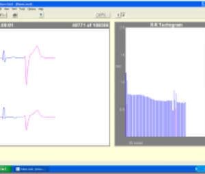 Forest Medical Trillium Gold Holter Analysis Software