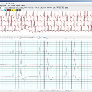 NorthEast Monitoring Holter LX Analysis Software