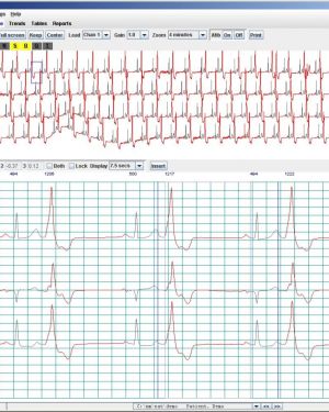 NorthEast Monitoring Holter LX Analysis Software