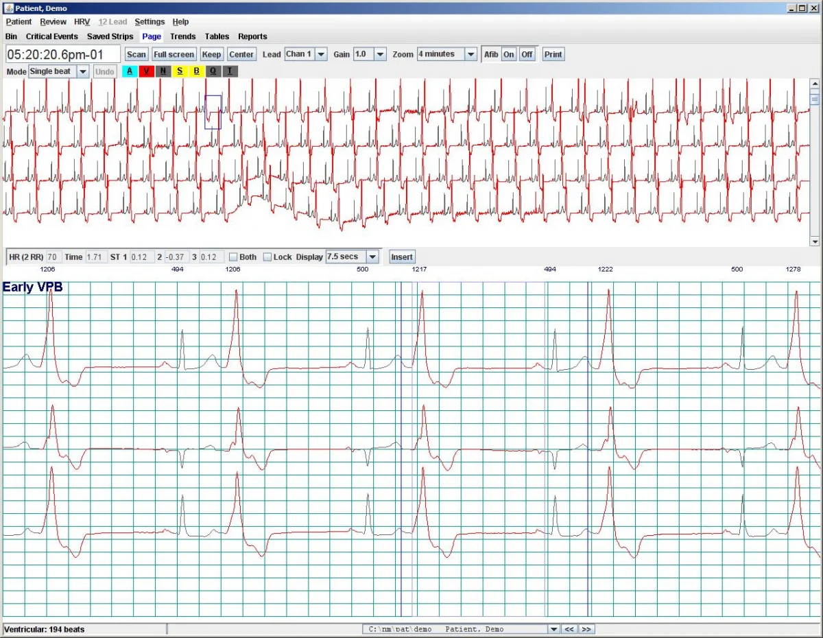 NorthEast Monitoring Holter LX Analysis Software