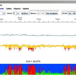 NorthEast Monitoring LX Sleep Software