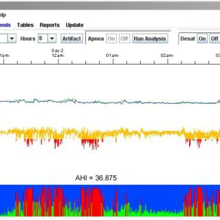 NorthEast Monitoring LX Sleep Software