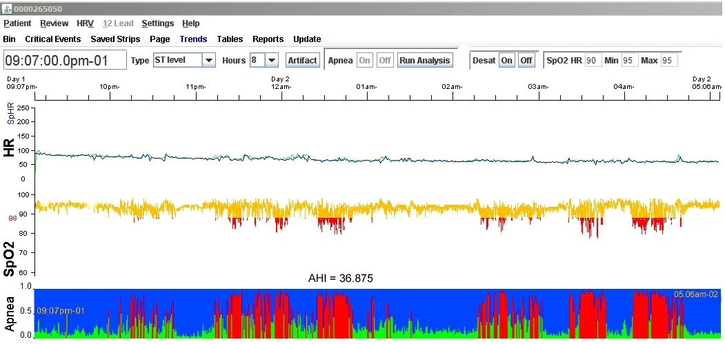 NorthEast Monitoring LX Sleep Software