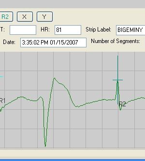 NorthEast Monitoring LX Event Software