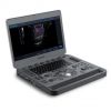 SonoScape X5 Portable Color Ultrasound System