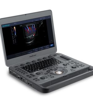 SonoScape X5 Portable Color Ultrasound System