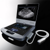 Edan Acclarix AX8 VET Diagnostic Ultrasound System