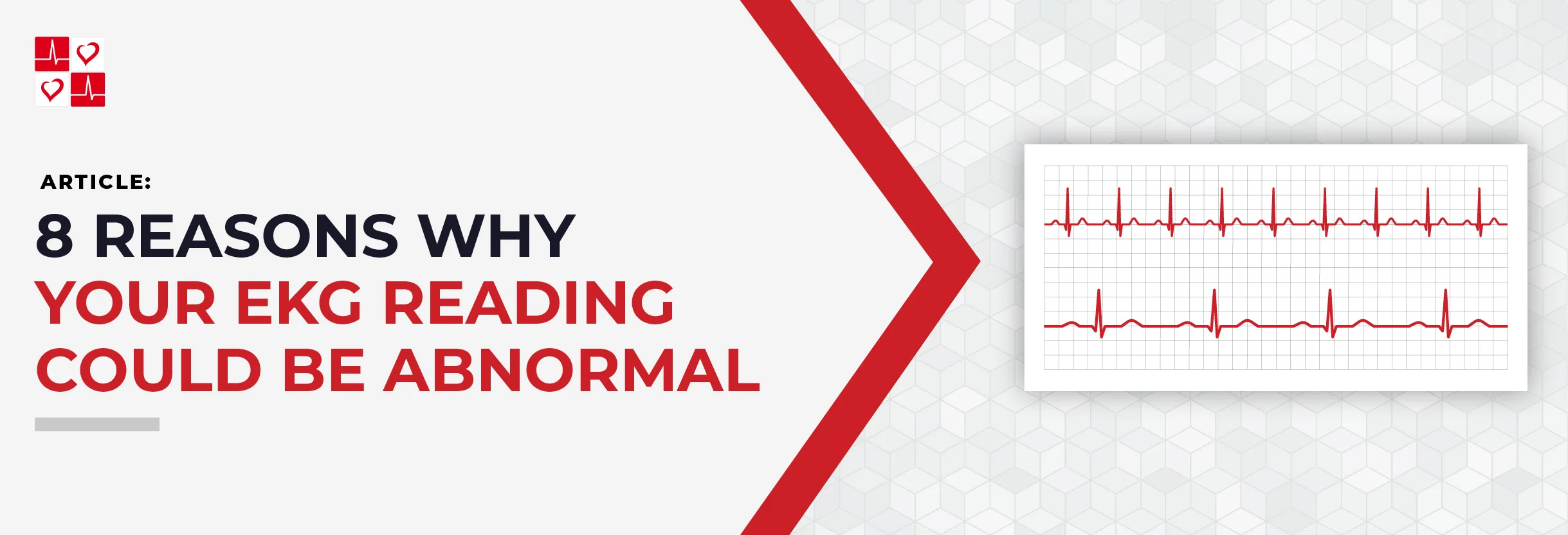 8_Reasons_Why_Your_EKG_Reading_Could_Be_Abnormal_Title_Banner