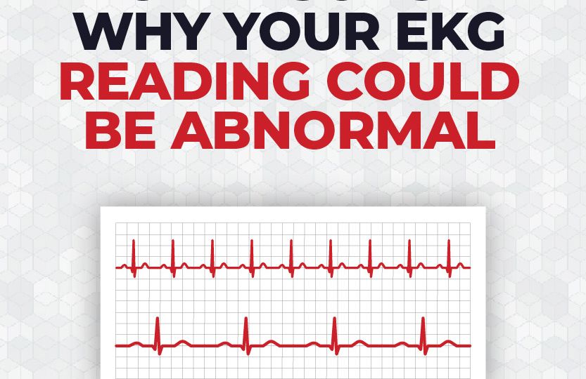 8_Reasons_Why_Your_EKG_Reading_Could_Be_Abnormal_Title_Icon