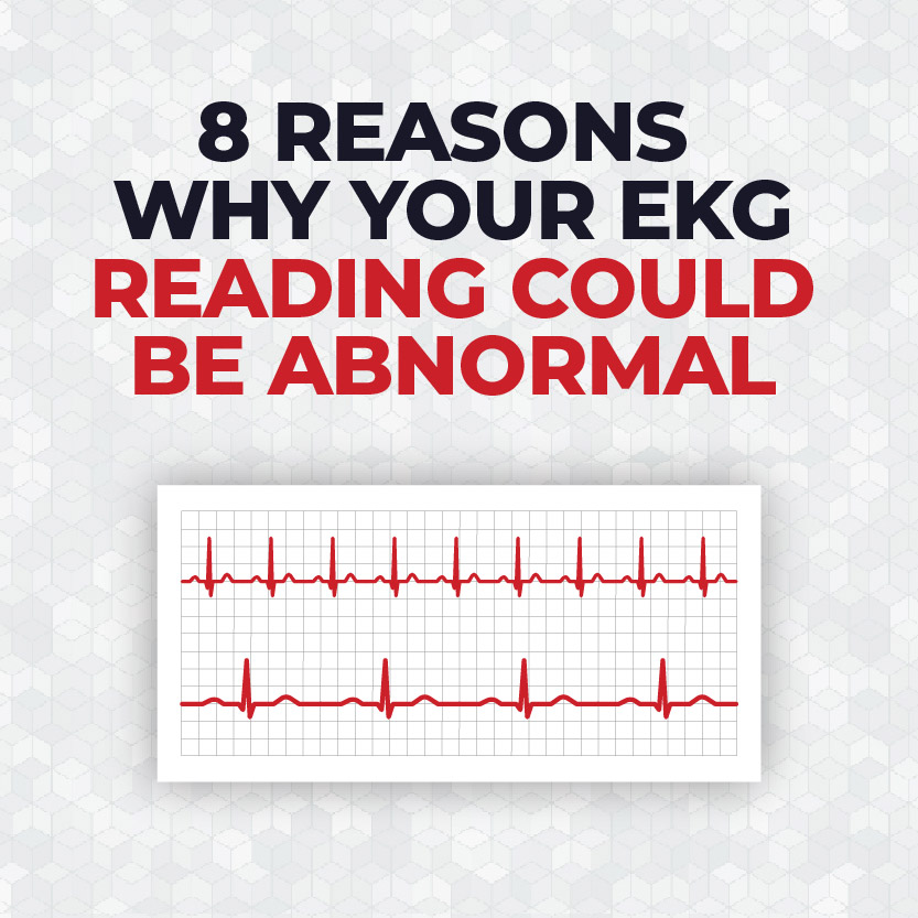 8_Reasons_Why_Your_EKG_Reading_Could_Be_Abnormal_Title_Icon