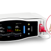 Masimo Radical-7 Pulse CO-Oximeter